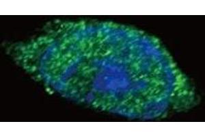 Confocal immunofluorescent analysis of JAK2 antibody with HeLa cells followed by Alexa Fluor 488-conjugated goat anti-rabbit lgG (green).