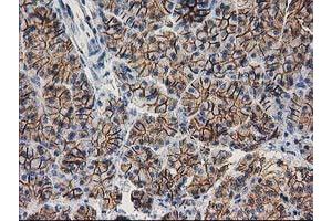 Image no. 9 for anti-Catenin (Cadherin-Associated Protein), beta 1, 88kDa (CTNNB1) antibody (ABIN1496889)