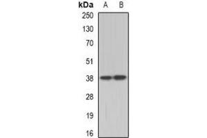 Western blot analysis of TEL2 expression in A431 (A), Hela (B) whole cell lysates. (ETV7 anticorps)