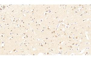 Detection of NSE in Human Cerebrum Tissue using Polyclonal Antibody to Enolase, Neuron Specific (NSE)