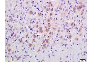 Formalin-fixed and paraffin embedded rat brain labeled with Anti-EPS8 Polyclonal Antibody, Unconjugated (ABIN705011) at 1:200 followed by conjugation to the secondary antibody and DAB staining.
