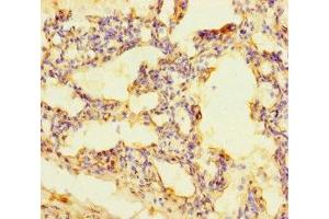 Immunohistochemistry of paraffin-embedded human lung tissue using ABIN7168465 at dilution of 1:100 (RUFY4 anticorps  (AA 174-473))