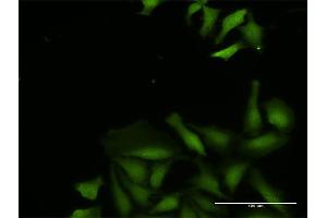 Immunofluorescence of purified MaxPab antibody to CDADC1 on HeLa cell. (CDADC1 anticorps  (AA 1-514))