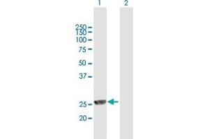 Western Blot analysis of MPHOSPH8 expression in transfected 293T cell line by MPHOSPH8 MaxPab polyclonal antibody. (MPHOSPH8 anticorps  (AA 1-259))