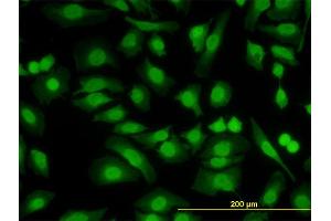 Immunofluorescence of monoclonal antibody to PKNOX2 on HeLa cell.