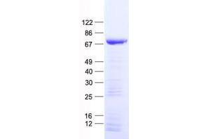 Validation with Western Blot (ZNF583 Protein (His tag))