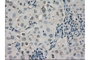 Image no. 7 for anti-Crystallin, alpha B (CRYAB) antibody (ABIN1497645) (CRYAB anticorps)