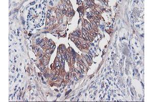 Image no. 9 for anti-phosphofructokinase, Platelet (PFKP) antibody (ABIN1500164)