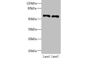 Western blot All lanes: IFRD2 antibody at 12 μg/mL Lane 1: Hela whole cell lysate Lane 2: PC-3 whole cell lysate Secondary Goat polyclonal to rabbit IgG at 1/10000 dilution Predicted band size: 55, 66 kDa Observed band size: 55 kDa
