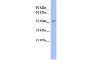 Image no. 1 for anti-Gastrulation Brain Homeo Box 2 (GBX2) (AA 179-228) antibody (ABIN6742290) (GBX2 anticorps  (AA 179-228))