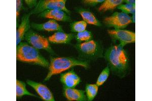 HeLa cell cultures stained with Ubiquilin 2 / UBQLN2 antibody (green) and chicken polyclonal antibody to vimentin (red). (Ubiquilin 2 anticorps)