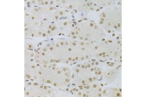 Immunohistochemistry of paraffin-embedded human stomach using HMGB1 Antibody. (HMGB1 anticorps  (AA 100-200))