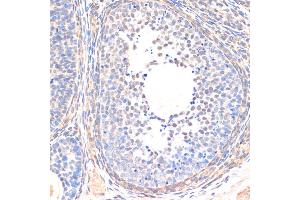 Immunohistochemistry of paraffin-embedded rat ovary using SM antibody (ABIN6128714, ABIN6148090, ABIN6148091 and ABIN6218232) at dilution of 1:200 (40x lens). (SMAD5 anticorps  (AA 186-465))