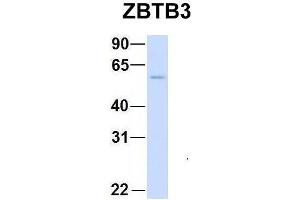 Host:  Rabbit  Target Name:  CHAD  Sample Type:  Human Adult Placenta  Antibody Dilution:  1. (ZBTB3 anticorps  (Middle Region))