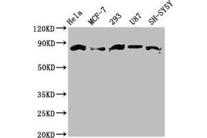 Western Blot Positive WB detected in: Hela whole cell lysate, MCF-7 whole cell lysate, 293 whole cell lysate, U87 whole cell lysate, SH-SY5Y whole cell lysate All lanes: BARD1 antibody at 3. (BARD1 anticorps  (AA 428-777))