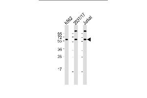 All lanes : Anti-Hsp 60 Antibody (N-term) at 1:2000 dilution Lane 1: K562 whole cell lysate Lane 2: 293T/17 whole cell lysate Lane 3: Jurkat whole cell lysate Lysates/proteins at 20 μg per lane. (HSPD1 anticorps  (N-Term))