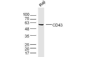 Raji cell lysates probed with CD43 Polyclonal Antibody, unconjugated  at 1:300 overnight at 4°C followed by a conjugated secondary antibody for 60 minutes at 37°C. (CD43 anticorps  (AA 101-200))