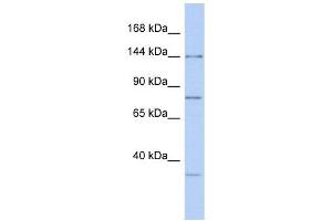 RNASEN antibody used at 1 ug/ml to detect target protein. (DROSHA anticorps  (Middle Region))