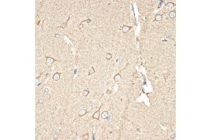 Immunohistochemistry of paraffin-embedded human brain using B Rabbit mAb (ABIN1680181, ABIN7101458, ABIN7101459 and ABIN7101460) at dilution of 1:100 (40x lens). (BCAP31 anticorps)