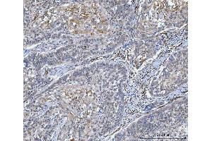 IHC analysis of SLC9A3R2 using anti-SLC9A3R2 antibody (ABIN7599271).