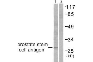 Western Blotting (WB) image for anti-Prostate Stem Cell Antigen (PSCA) (Internal Region) antibody (ABIN1848753) (PSCA anticorps  (Internal Region))