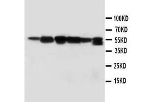 Anti-ABI1 antibody, Western blotting Lane 1: Rat Liver Tissue Lysate Lane 2: Rat Brain Tissue Lysate Lane 3: MM231 Cell Lysate Lane 4: HELA Cell Lysate Lane 5: SMMC Cell Lysate  Lane 6: JURKAT Cell Lysate (ABI1 anticorps  (C-Term))