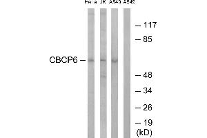 Western blot analysis of extracts from HeLa cells, Jurkat cells and A549 cells, using CBCP6 antibody. (AGBL4 anticorps)