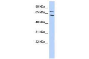Image no. 1 for anti-Metastasis Associated 1 Family, Member 2 (MTA2) (AA 35-84) antibody (ABIN6740437) (MTA2 anticorps  (AA 35-84))