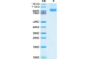 Human CD31 on Tris-Bis PAGE under reduced condition.