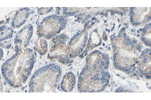 ABIN6269275 at 1/100 staining Human prostate tissue by IHC-P. (GSK3 alpha anticorps  (N-Term))