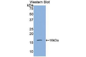 Western blot analysis of the recombinant protein. (VPREB1 anticorps  (AA 43-134))