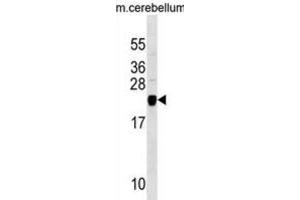 Western Blotting (WB) image for anti-Transgelin 3 (TAGLN3) antibody (ABIN3000208)