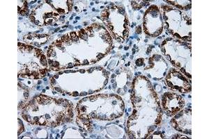 Immunohistochemical staining of paraffin-embedded Kidney tissue using anti-RIC8A mouse monoclonal antibody. (RIC8A anticorps)