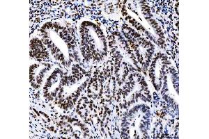 IHC analysis of HDAC2 using anti-HDAC2 antibody (ABIN7601564). (HDAC2 anticorps  (AA 387-488))