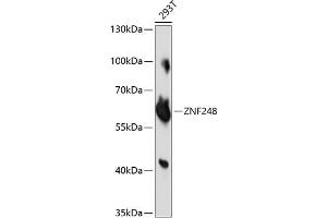 Western blot analysis of extracts of 293T cells, using ZNF248 antibody (ABIN7271470) at 1:1000 dilution. (ZNF248 anticorps  (AA 1-110))