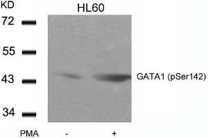 Western blot analysis of extracts from HL60 cells untreated or treated with PMA using GATA1(Phospho-Ser142) Antibody. (GATA1 anticorps  (pSer142))