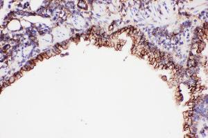 Anti-ICAM1 Picoband antibody,  IHC(P): Mouse Lung Tissue