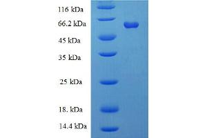 SDS-PAGE (SDS) image for Galactose-1-Phosphate Uridylyltransferase (GALT) (AA 1-379), (full length) protein (His-SUMO Tag) (ABIN5709555)