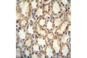immunohistochemistry analysis in formalin fixed and paraffin embedded human kidney tissue reacted with KCNT2 / SLICK Antibody (C-term) followed by peroxidase conjugation of the secondary antibody and DAB staining.