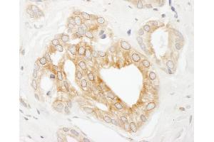 Immunohistochemistry (IHC) image for anti-Ubiquitin Protein Ligase E3 Component N-Recognin 4 (UBR4) (AA 150-200) antibody (ABIN7454442)