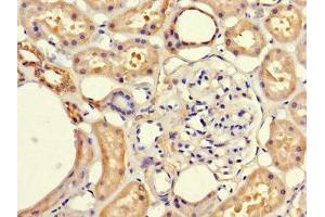 Immunohistochemistry of paraffin-embedded human kidney tissue using ABIN7152681 at dilution of 1:100 (FRMD5 anticorps  (AA 295-504))