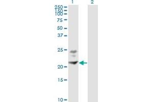 Western Blot analysis of BST2 expression in transfected 293T cell line by BST2 monoclonal antibody (M02), clone 3H4. (BST2 anticorps  (AA 40-180))