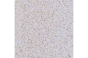 IHC analysis of SNRNP200 using anti-SNRNP200 antibody (ABIN7602032).