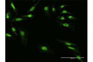 Immunofluorescence of purified MaxPab antibody to ZNF668 on HeLa cell. (ZNF668 anticorps  (AA 1-619))