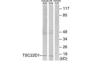 Western Blotting (WB) image for anti-TSC22 Domain Family, Member 1 (TSC22D1) (N-Term) antibody (ABIN1849646) (TSC22D1 anticorps  (N-Term))