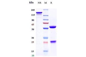 Anti-TNFSF2 / TNFa Reference Antibody (certolizumAb) on SDS-PAGE under reducing (R) condition.