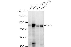 Western blot analysis of extracts of various cell lines, using CPT1A antibody (ABIN7266089) at 1:1000 dilution. (CPT1A anticorps  (AA 497-756))