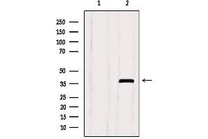 Western blot analysis of extracts from Myeloma cells, using SEPT9 Antibody.