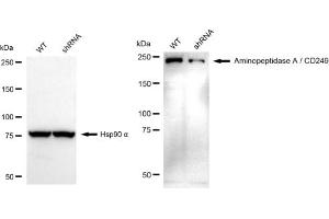 Western blotting analysis using Aminopeptidase A / CD249 antibody (ABIN7798749).