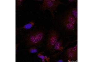 Immunofluorescence staining of methanol-fixed Hela cells using JunB(Phospho-Ser79) Antibody.